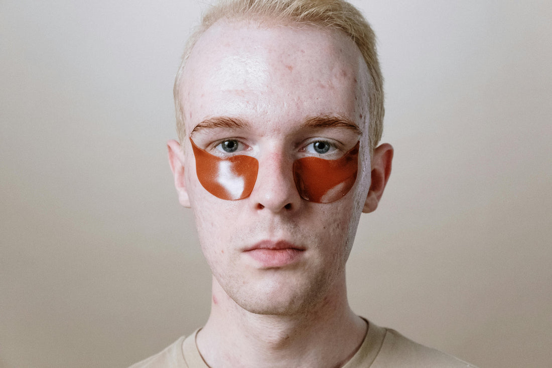 Retinol vs. Vitamin C: Which Anti-Aging Ingredient Is Better?